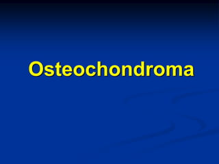 Osteochondroma
 