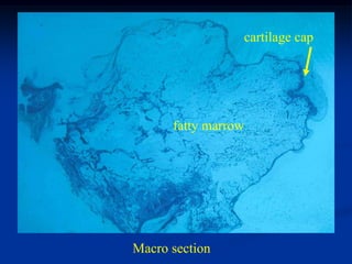 cartilage cap




      fatty marrow




Macro section
 