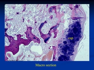 cap




Macro section
 