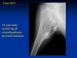 Case #611




10 year male
sessile based
osteochondroma
proximal humerus
 