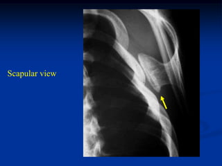 Scapular view
 