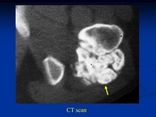 CT scan
 