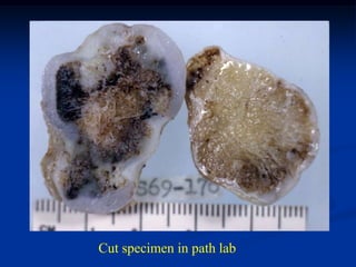 cap




Cut specimen in path lab
 