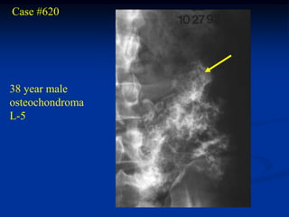 Case #620




38 year male
osteochondroma
L-5
 