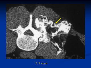 CT scan
 