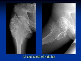 AP and lateral of right hip
 