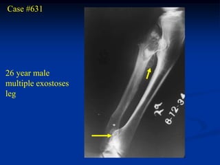 Case #631




26 year male
multiple exostoses
leg
 