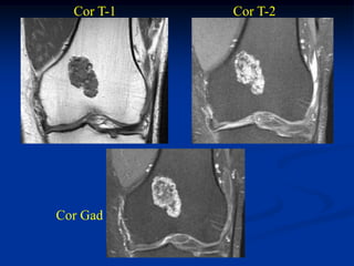 Cor T-1   Cor T-2




Cor Gad
 