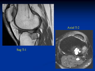 Axial T-2




Sag T-1
 