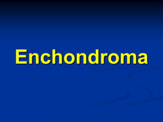 Enchondroma
 