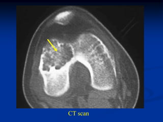 CT scan
 