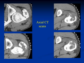 Axial CT
 scans
 