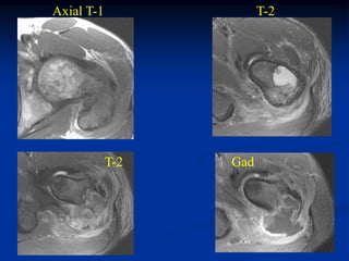 Axial T-1               T-2




            T-2   Gad
 