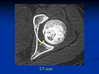 CT scan
 