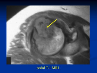 Axial T-1 MRI
 
