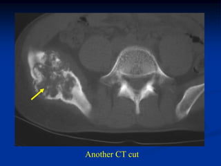 Another CT cut
 