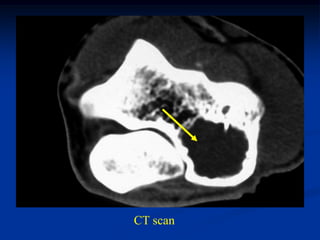 CT scan
 