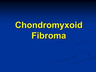 Chondromyxoid
   Fibroma
 