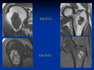 Cor T-1’s




Cor T-2’s
 