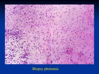 Biopsy photomic
 