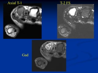 Axial T-1         T-2 FS




            Gad
 