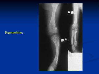 Extremities
 
