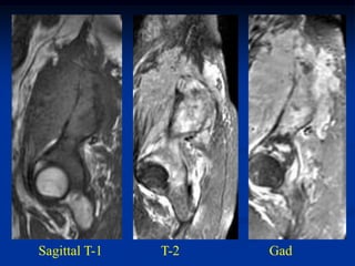 Sagittal T-1   T-2   Gad
 