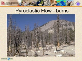 Pyroclastic Flow - burns
 