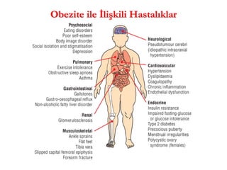 Obezite ile İlişkili Hastalıklar  