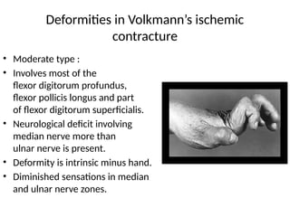 Diminished Hand Sign volkmannsischemiccontracture-171220111547.pptx