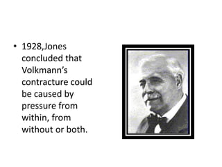 • 1928,Jones
concluded that
Volkmann’s
contracture could
be caused by
pressure from
within, from
without or both.
 