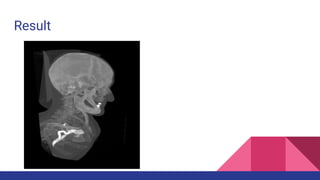 Volume Rendering in Unity3D | PDF
