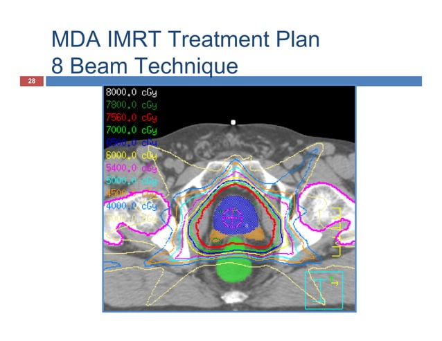 Volumetric Modulated Arc Therapy | PPT