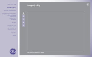 Voluson E6 Radiance Voluson E6 Radiance