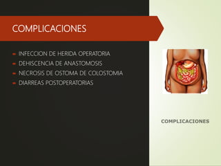 COMPLICACIONES
 INFECCION DE HERIDA OPERATORIA
 DEHISCENCIA DE ANASTOMOSIS
 NECROSIS DE OSTOMA DE COLOSTOMIA
 DIARREAS POSTOPERATORIAS
 