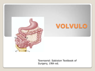 VOLVULO
Townsend: Sabiston Textbook of
Surgery, 19th ed.
 