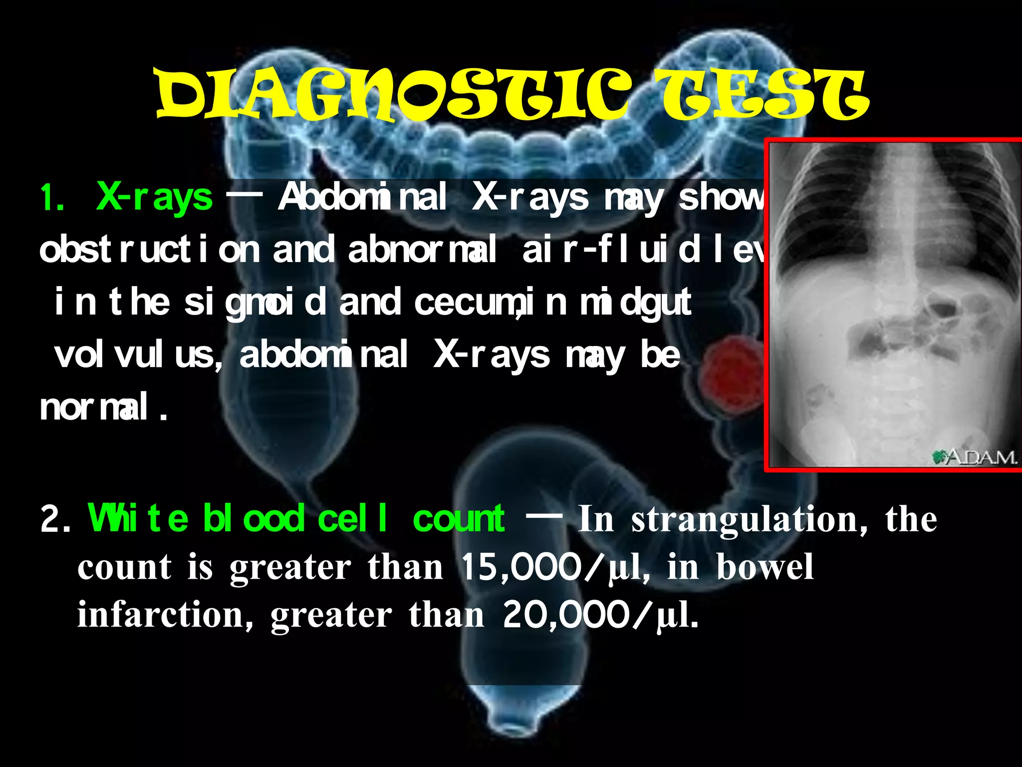DIAGNOSTIC TEST
1. X-r ays — A    bdom nal X-r ays m show
                      i              ay
obst r uct i on and abnor m ai r -f l ui d l evel s
                           al
               oi             ,i
 i n t he si gm d and cecum n m dgut
                                   i
 vol vul us, abdom nal X-r ays m be
                    i             ay
nor m .
      al

2. W t e bl ood cel l count — In strangulation, the
    hi
  count is greater than 15,000/µl, in bowel
  infarction, greater than 20,000/µl.
 