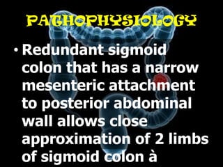 PATHOPHYSIOLOGY

• Redundant sigmoid
  colon that has a narrow
  mesenteric attachment
  to posterior abdominal
  wall allows close
  approximation of 2 limbs
  of sigmoid colon à
 