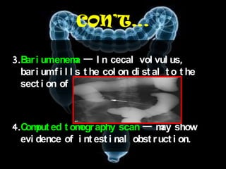 CON’T…

3.B i umenem — I n cecal vol vul us,
   ar             a
  bar i umf i l l s t he col on di st al t o t he
  sect i on of cecum    .



4.C put ed t om aphy scan — m show
   om          ogr                    ay
  evi dence of i nt est i nal obst r uct i on.
 