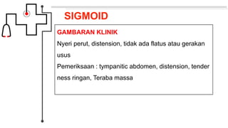 SIGMOID
GAMBARAN KLINIK
Nyeri perut, distension, tidak ada flatus atau gerakan
usus
Pemeriksaan : tympanitic abdomen, distension, tender
ness ringan, Teraba massa
 