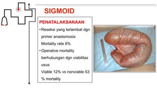 SIGMOID
PENATALAKSANAAN
• Reseksi yang terlambat dgn
primer anastomosis
Mortality rate 8%
• Operative mortality
berhubungan dgn viabilitas
usus
Viable 12% vs nonviable 53
% mortality
 