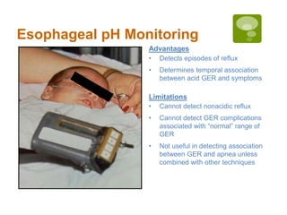 Esophageal pH Monitoring
• Cannot detect nonacidic reflux
• Cannot detect GER complications
associated with “normal” range of
GER
• Not useful in detecting association
between GER and apnea unless
combined with other techniques
Limitations
• Detects episodes of reflux
• Determines temporal association
between acid GER and symptoms
Advantages
 