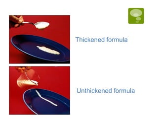 Thickened formula
Unthickened formula
 