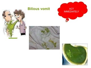 Bilious vomit ACT
IMMEDIATELY
 
