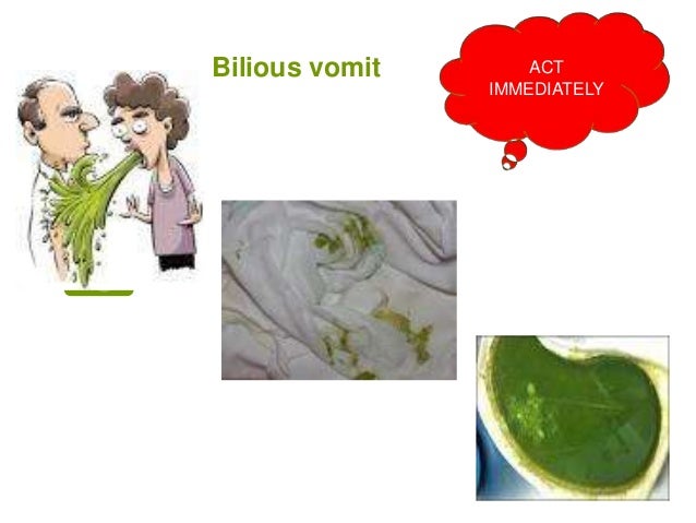 vomiting bile vomiting in children vomiting bile vomiting in children