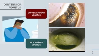 vomiting in surgery,its types,details.pptx