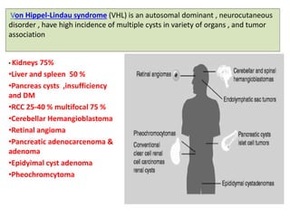 Von Hippel-Lindau syndrome (VHL) is an autosomal dominant , neurocutaneous 
disorder , have high incidence of multiple cysts in variety of organs , and tumor 
association 
• Kidneys 75% 
•Liver and spleen 50 % 
•Pancreas cysts ,insufficiency 
and DM 
•RCC 25-40 % multifocal 75 % 
•Cerebellar Hemangioblastoma 
•Retinal angioma 
•Pancreatic adenocarcenoma & 
adenoma 
•Epidyimal cyst adenoma 
•Pheochromcytoma 
 