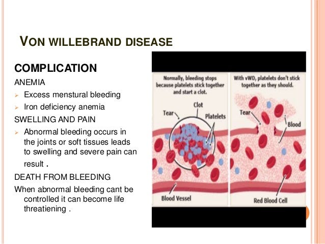 Willebrand S Disease In Dogs Willebrand S Disease In Dogs