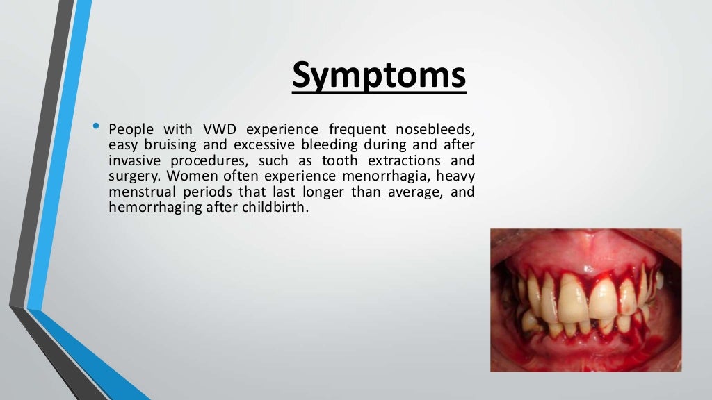Von willebrand disease
