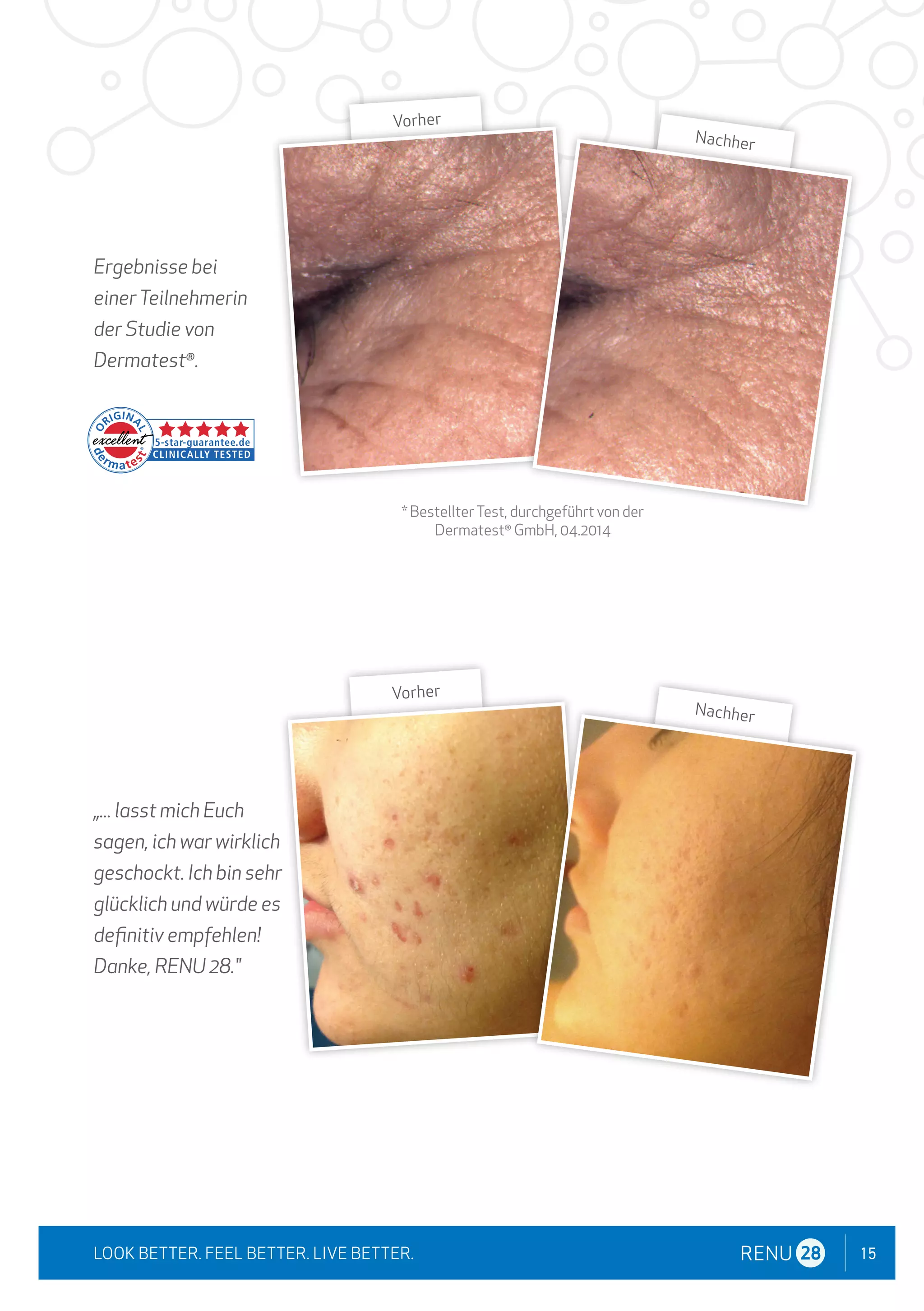 15
LOOK BETTER. FEEL BETTER. LIVE BETTER.
Ergebnisse bei
einerTeilnehmerin
der Studie von
Dermatest®
.
„... lasst mich Euch
sagen, ich war wirklich
geschockt. Ich bin sehr
glücklich und würde es
definitiv empfehlen!
Danke, RENU 28."
* BestellterTest, durchgeführt von der
Dermatest®
GmbH, 04.2014
Vorher
Nachher
Vorher
Nachher
 